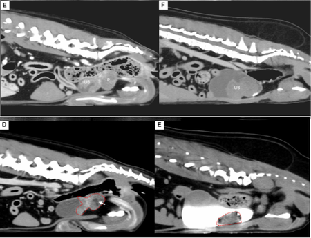 시술 전/ 시술 1개월 후 종양 크기를 비교한 CT 영상, 색전술을 통해서 종양 크기가 각각 58%, 60.9% 감소했다. (논문 발췌, 상단 사진: 시술 전 Case 1, 2 CT 영상, 하단 사진: 시술 1개월 후 Case 1, 2 CT 영상)