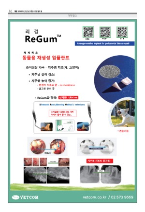 16면