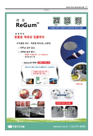 31면