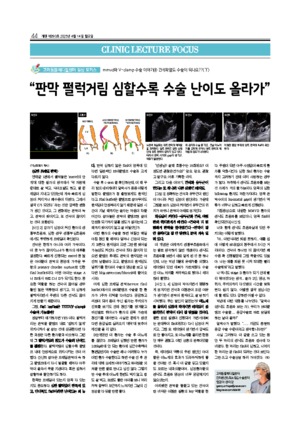 44면